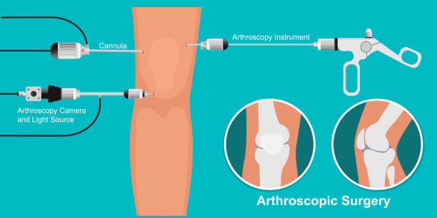 Best Knee Arthroscopic Surgeon In Mulund-1